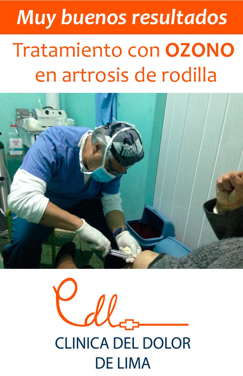 Artrosis de rodilla con ozono